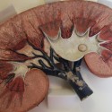 WVEL Health Watch: Cleansing Your Kidneys